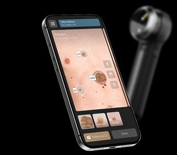 Its Arrived the All New Dermlite DL5 Plus