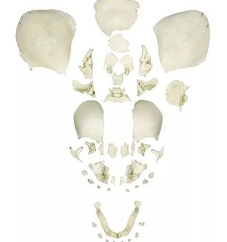 Disarticulated Human Fetal Skull, Full Term