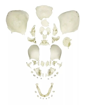 Disarticulated Human Fetal Skull, Full Term
