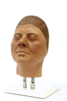 Head for facial injections, version F"