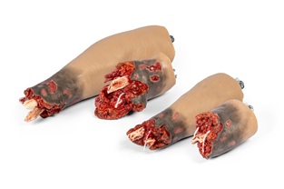 Amputation Models now available from Medstore.ie